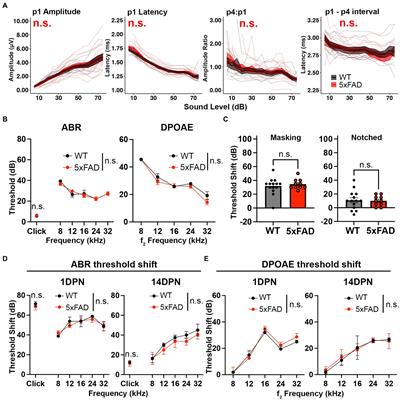 Increased central auditory gain in 5xFAD Alzheimer’s disease mice as an early biomarker candidate for Alzheimer’s disease diagnosis